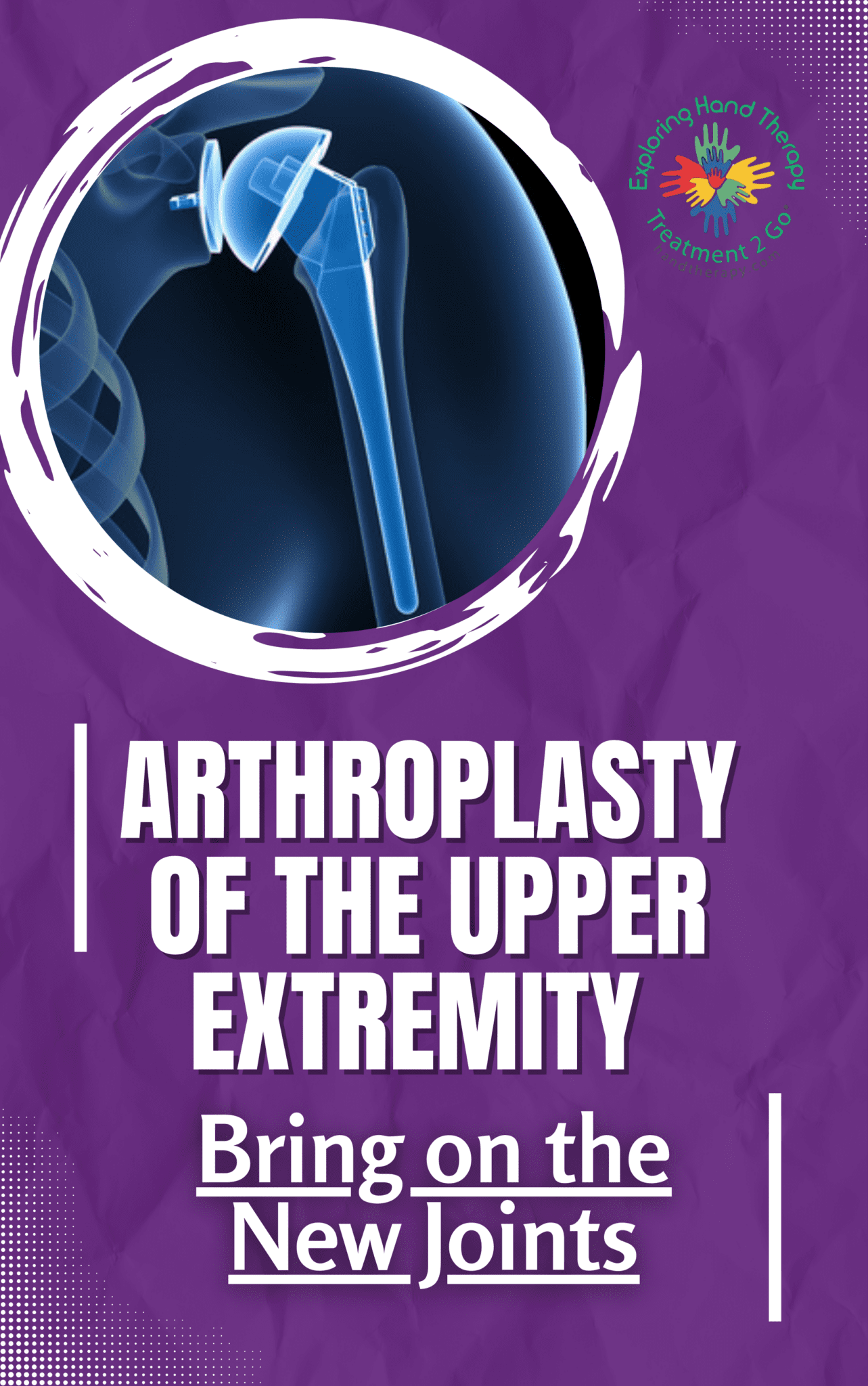 Arthroplasty of the Upper Extremity Bring on the New Joints