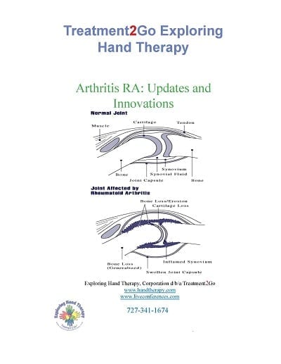 Arthritis RA: Updates and  Innovations