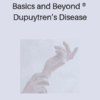 Basics and Beyond ® Dupuytren’s Disease