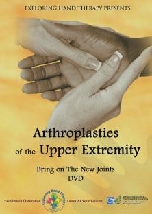 Arthroplasty of the Upper Extremity Bring on the New Joints Arthroplasty of the Upper Extremity Bring on the New Joints