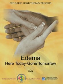 Edema Management:  Here Today, Gone Tomorrow