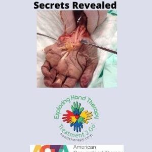 CMMS and WALANT: Flexor Tendon Repairs Secrets Revealed