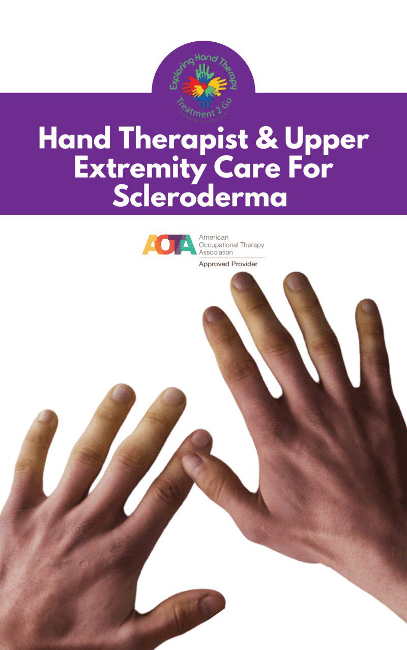 The Hand Therapist and Upper Extremity Care for Scleroderma